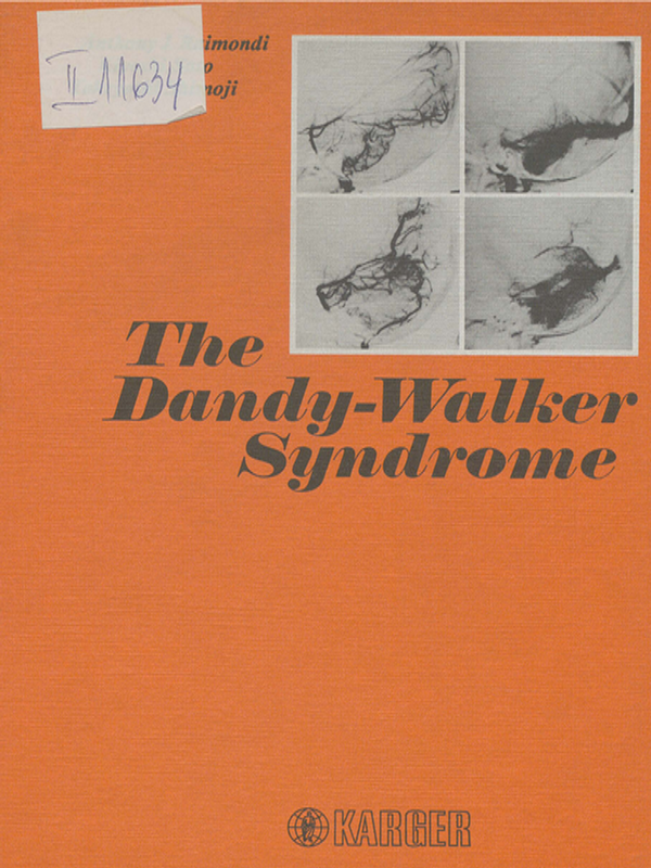 The Dandy-Walker syndrome