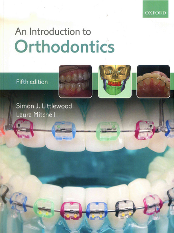 An introduction to orthodontics