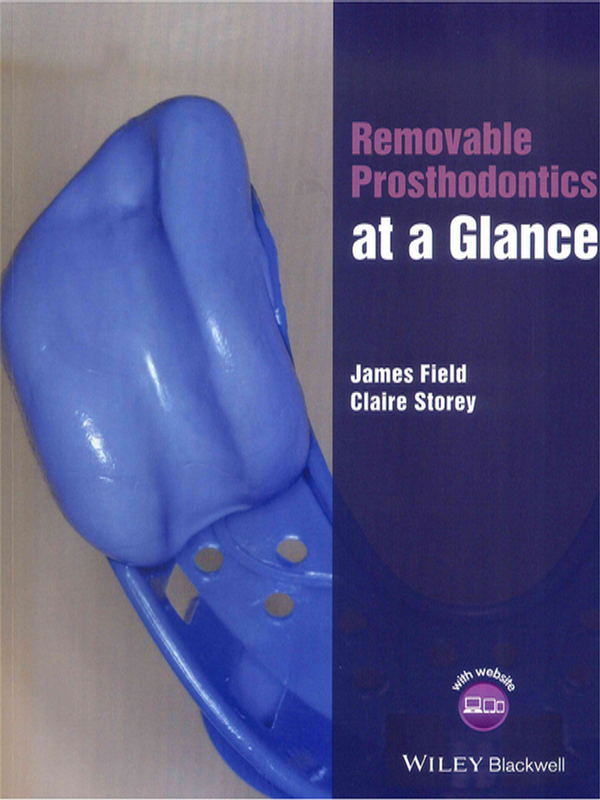 Removable prosthodontics at a glance