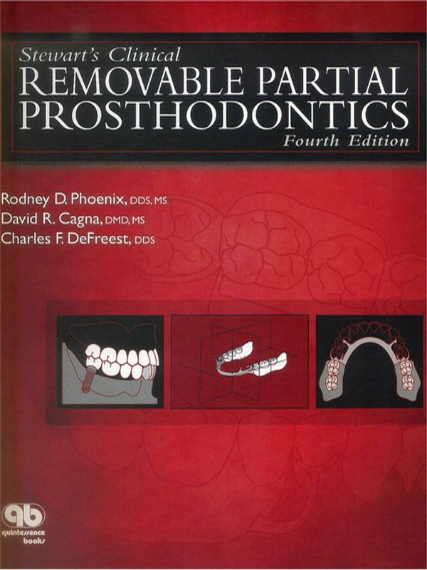 Stewart`s clinical removable partial prosthodontics