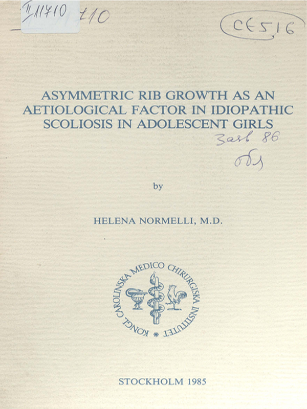 Asymmetric rib growth as an aetiological factor in idiopathic scoliosis in adolescent girls