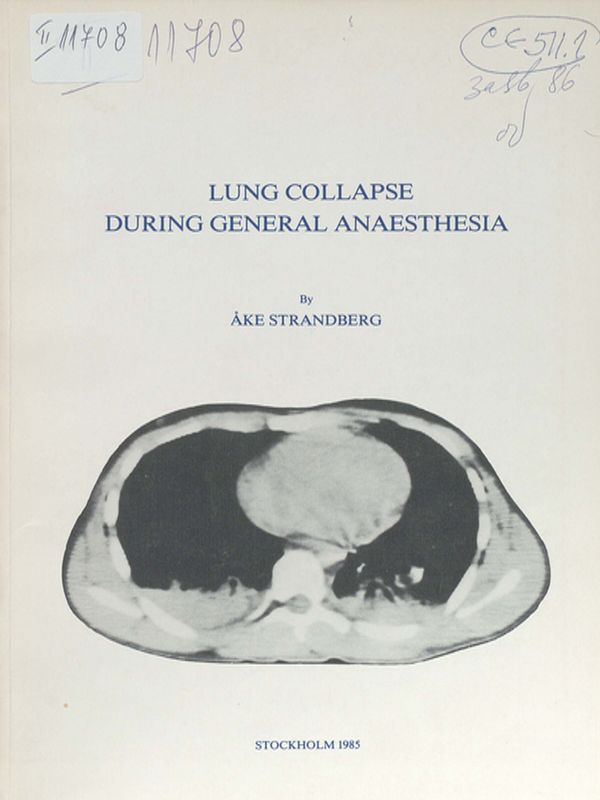 Lung collapse during general anaesthesia