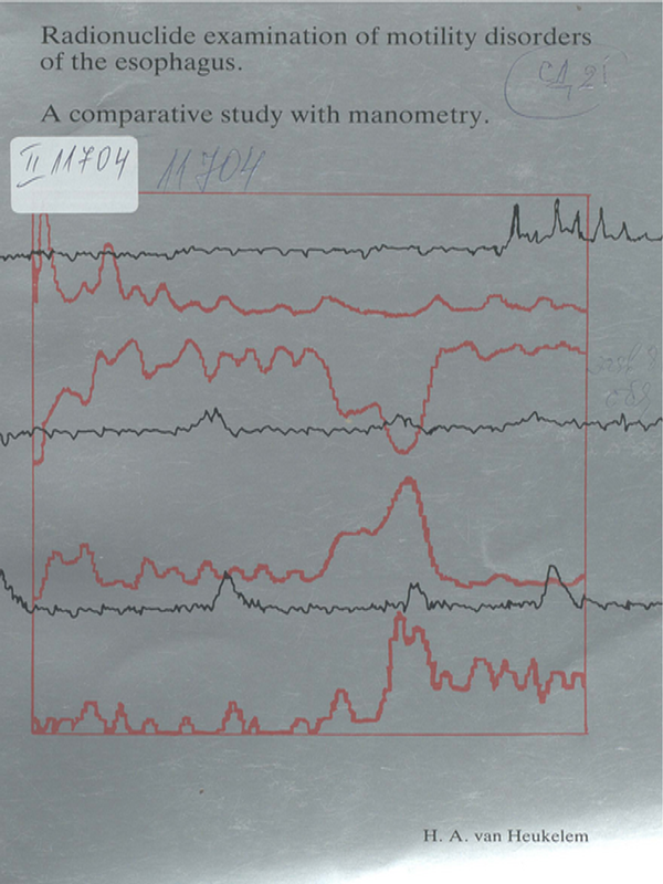 Radionuclide examination of motility disorders of the esophagus
