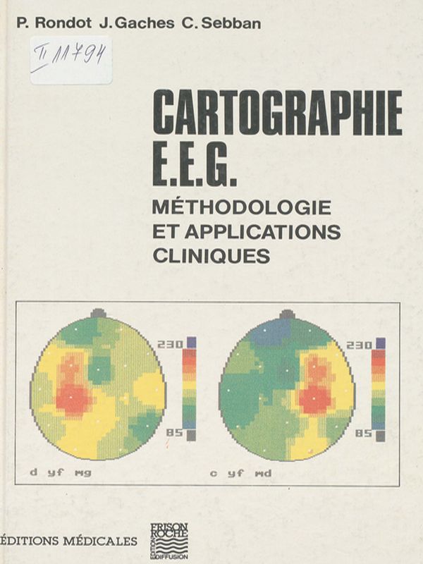 Cartographie EEG