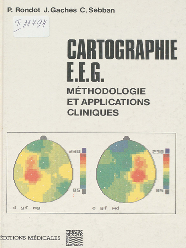 Cartographie EEG