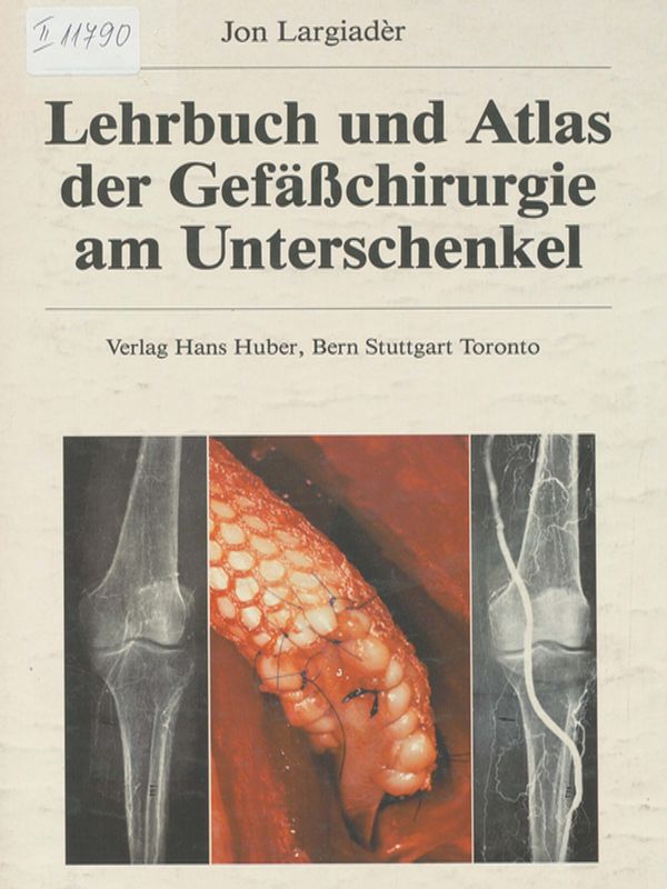 Lehrbuch und Atlas der Gefasschirurgie am Unterschenkel