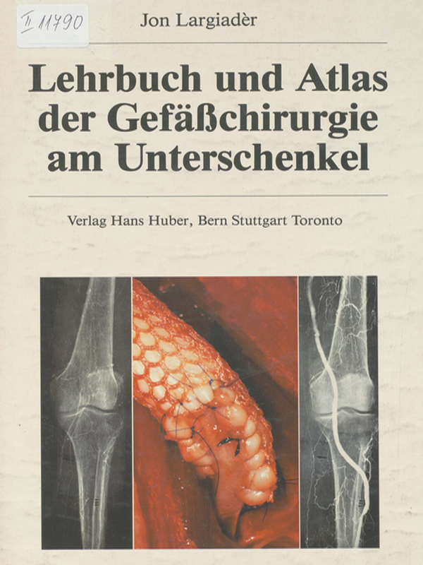 Lehrbuch und Atlas der Gefasschirurgie am Unterschenkel