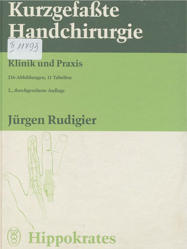 Kurzgefasste Handchirurgie