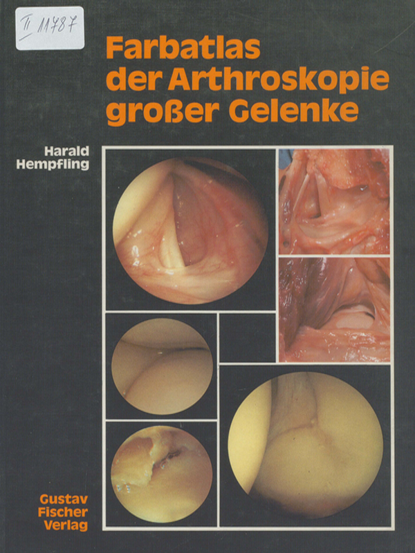 Farbatlas der Arthroskopie grosser Gelenke