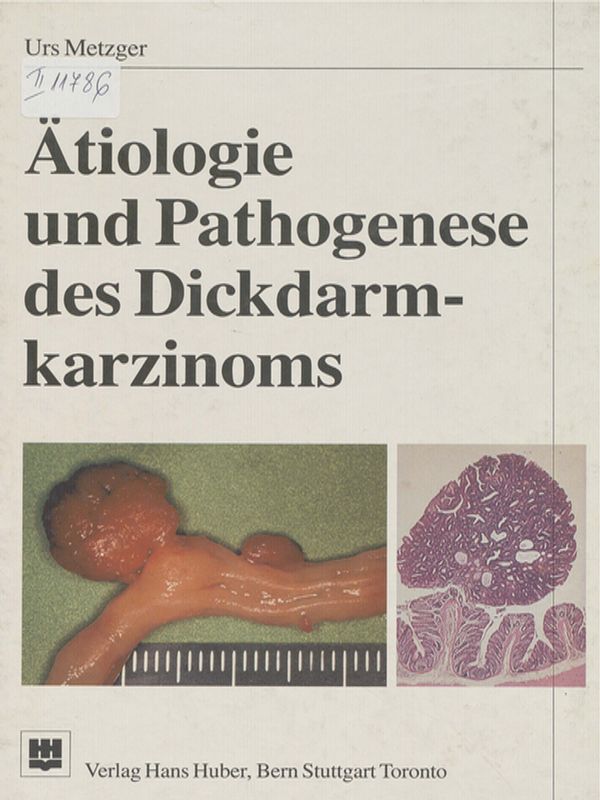 Atiologie und Pathogenese des Dickdarmkarzinoms