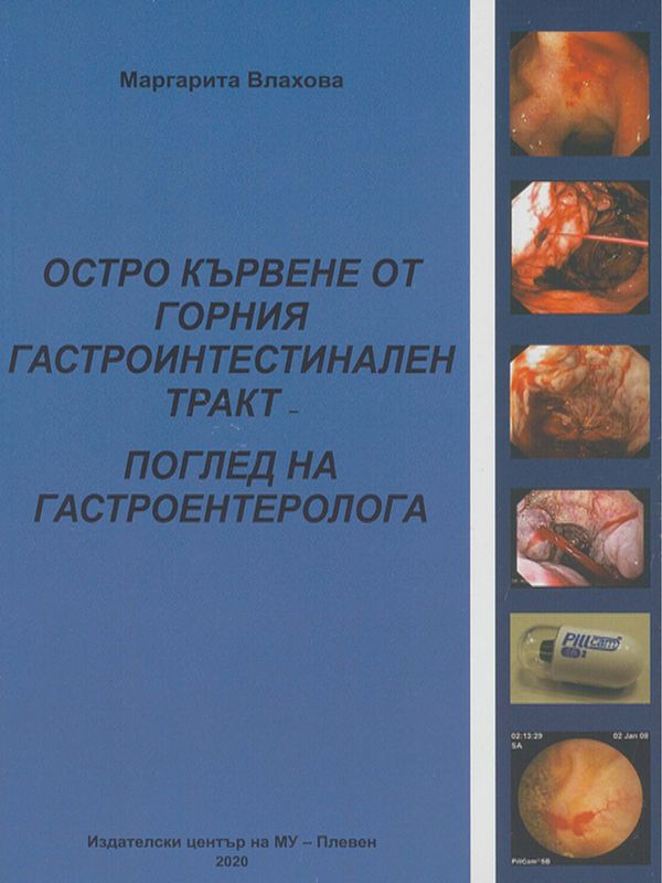 Остро кървене от горния гастроинтестинален тракт - поглед на гастроентеролога