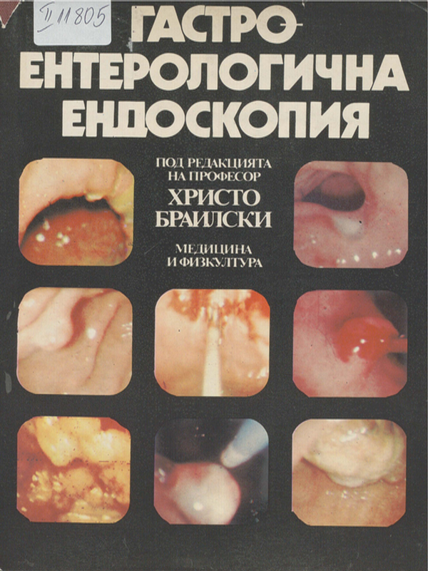 Гастроентерологична ендоскопия