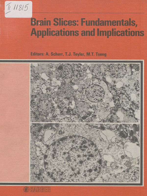 Brain slices