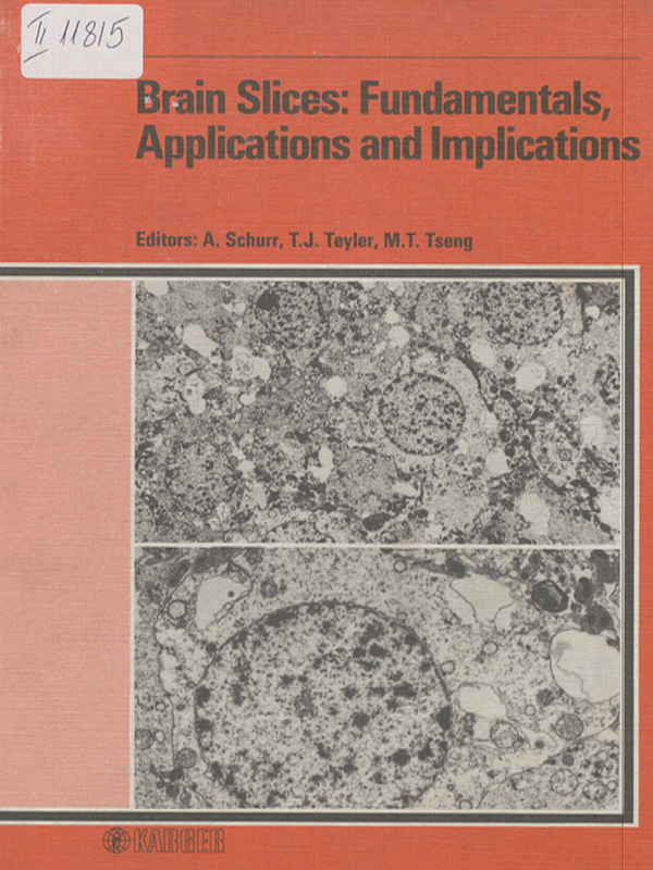 Brain slices