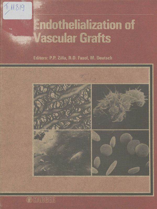 Endothelialization of vascular grafts