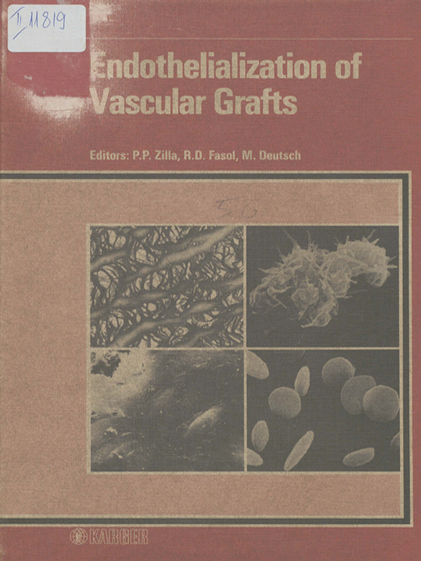 Endothelialization of vascular grafts