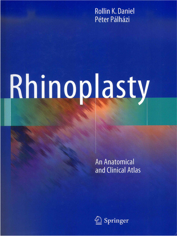 Rhinoplasty
