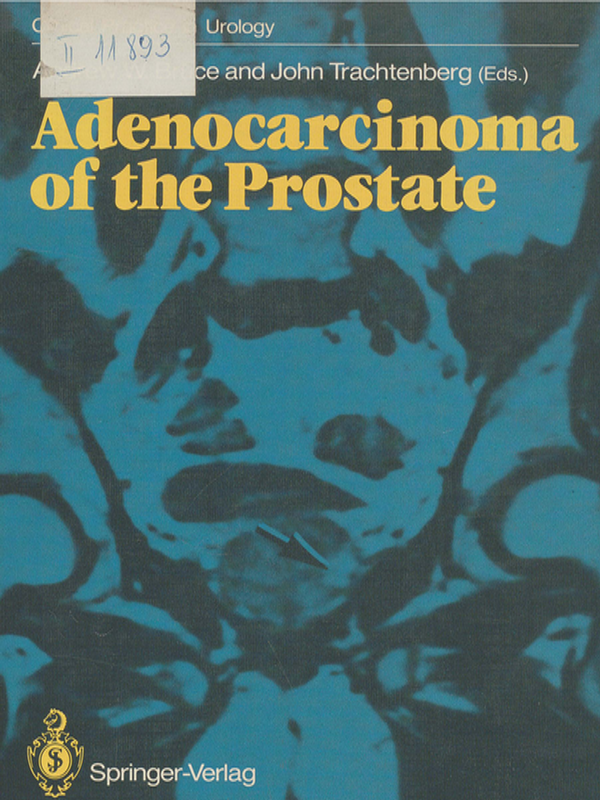 Adenocarcinoma of the Prostate