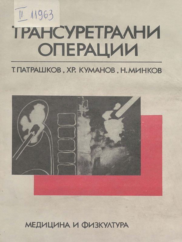 Трансуретрални операции