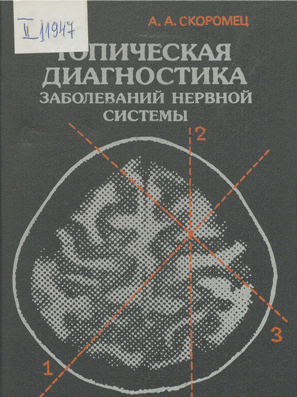Топическая диагностика заболеваний нервной системы