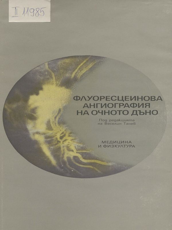 Флуоресцеинова ангиография на очното дъно