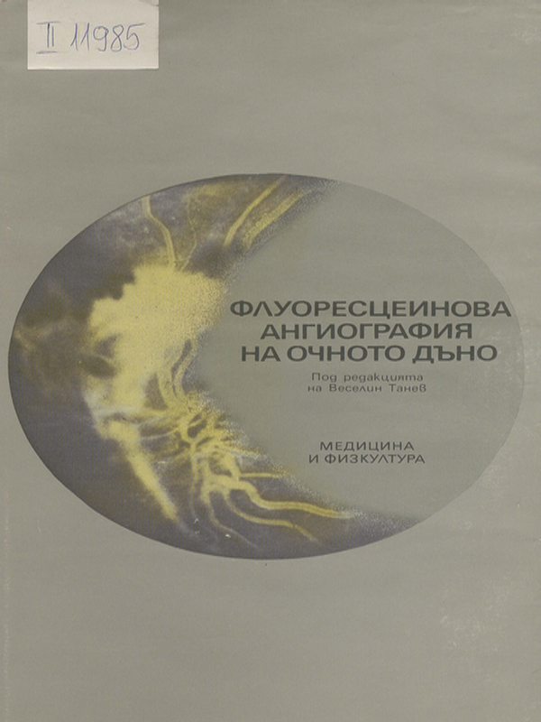 Флуоресцеинова ангиография на очното дъно