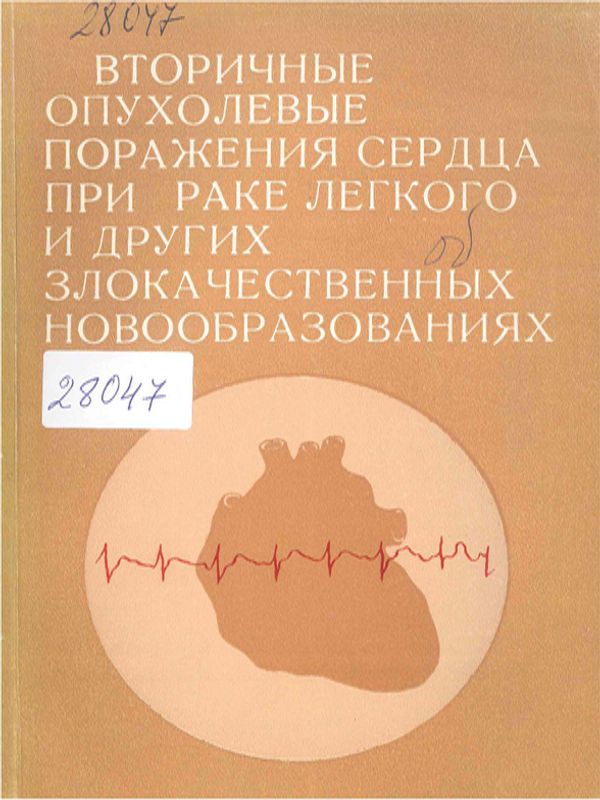 Вторичные опухолевые поражения сердца при раке легкого и других злокачественных новообразованиях