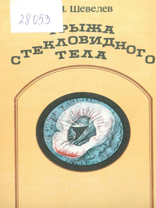 Грыжа стекловидного тела