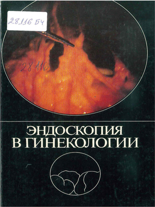 Эндоскопия в гинекологии