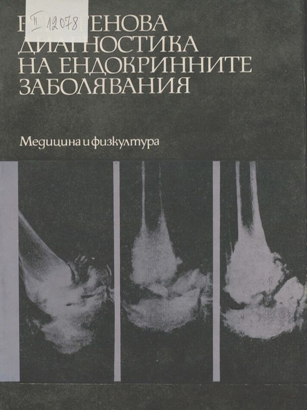 Рентгенова диагностика на ендокринните заболявания