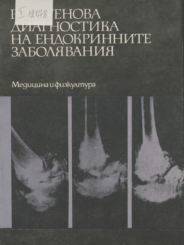 Рентгенова диагностика на ендокринните заболявания