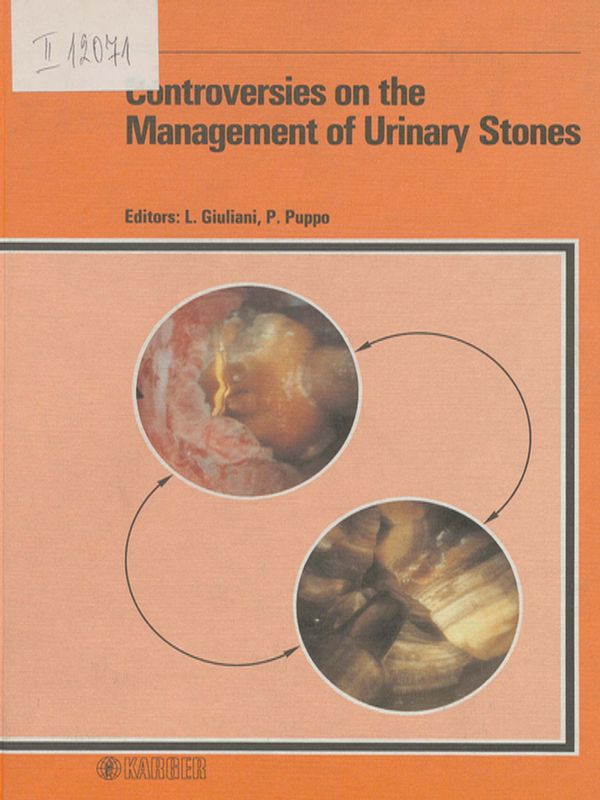Controversies on the management of urinary stones
