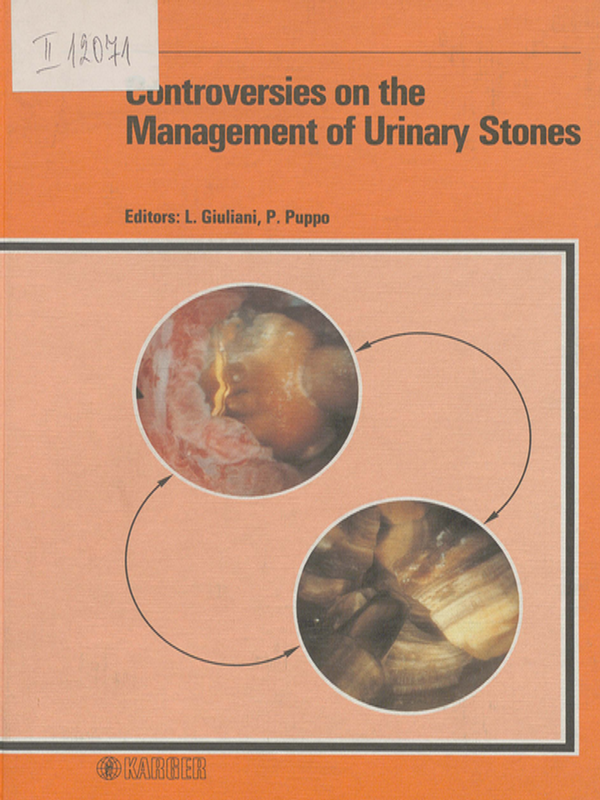 Controversies on the management of urinary stones