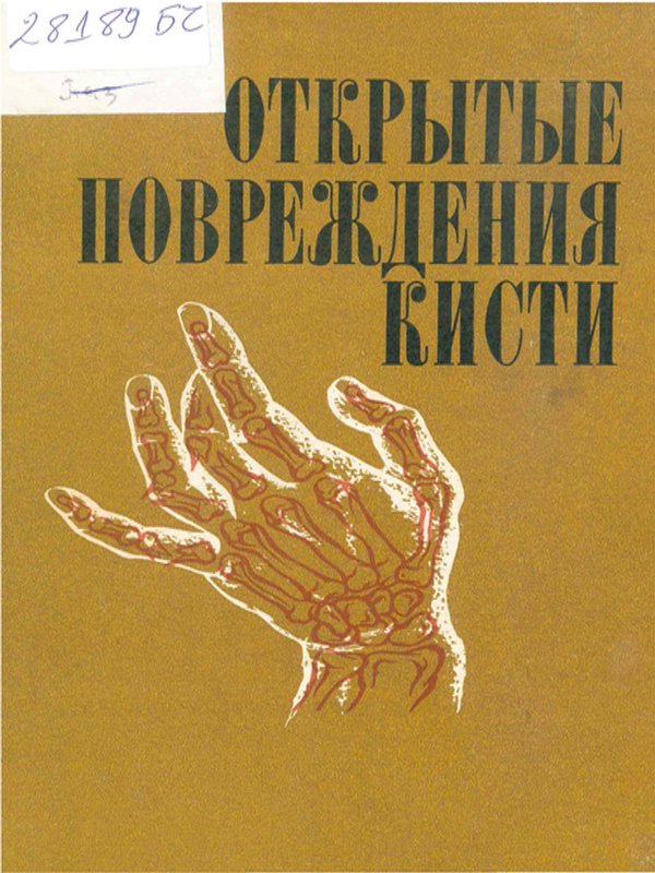 Открытые повреждения кисти