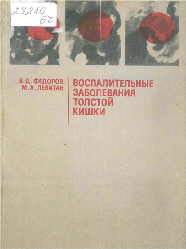 Воспалительные заболевания толстой кишки