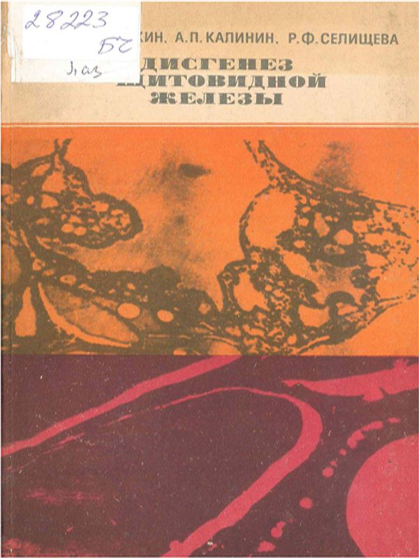 Дисгенез щитовидной железы