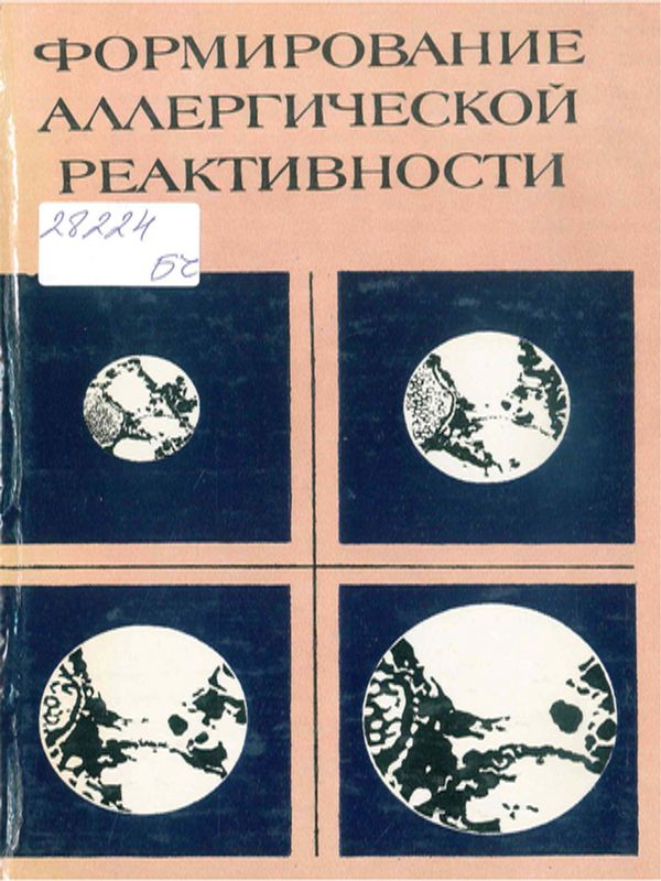 Формирование аллергической реактивности
