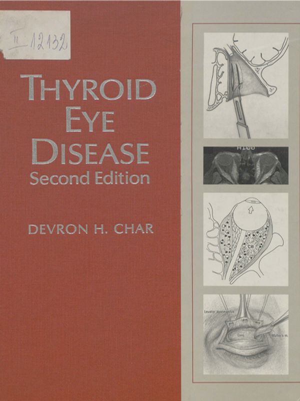Thyroid eye disease