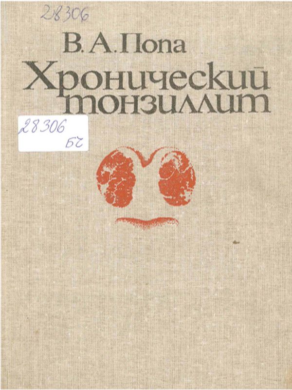 Хронический тонзиллит