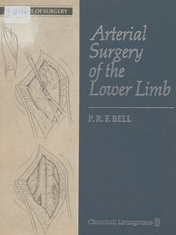 Arterial surgery of the lower limb