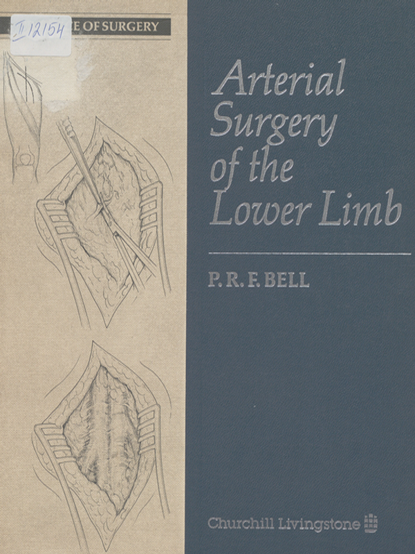 Arterial surgery of the lower limb