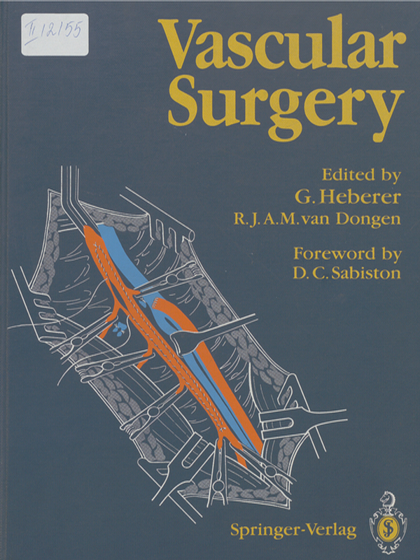 Vascular surgery