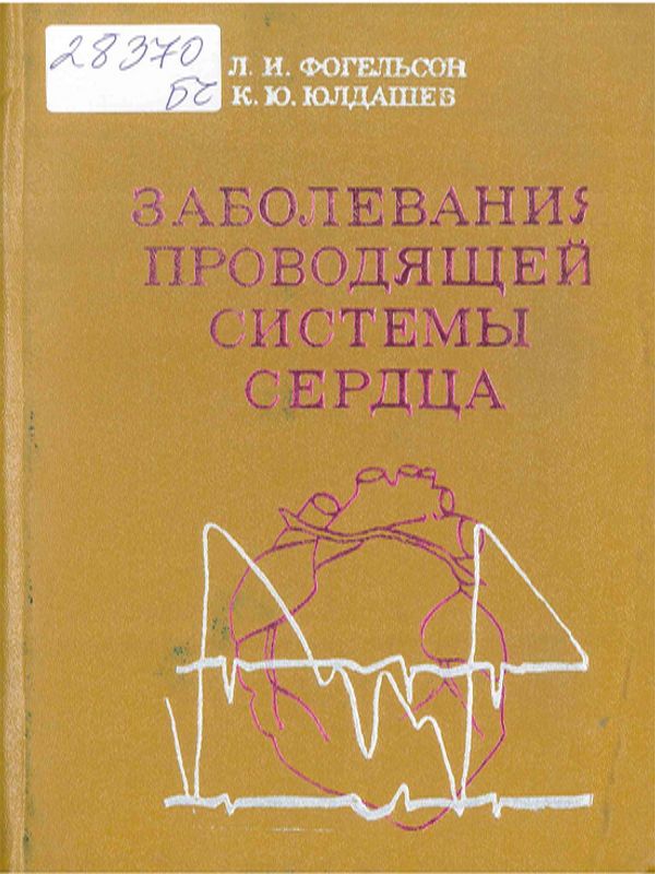 Заболевания проводящей системы сердца