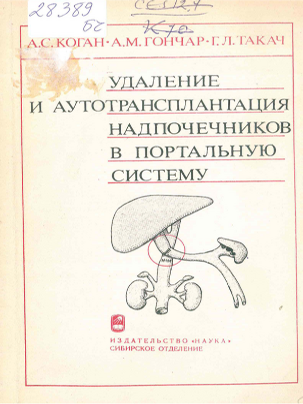 Удаление и аутотрансплантация надпочечников в портальную систему