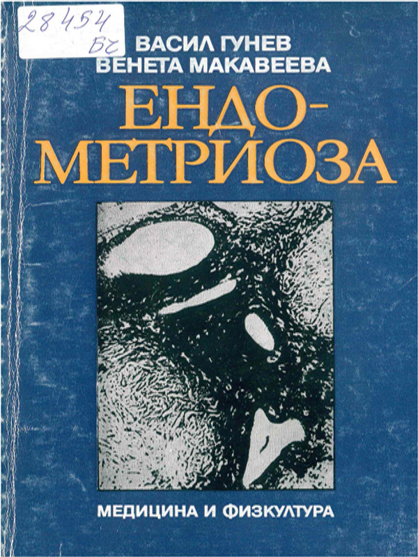 Ендометриоза