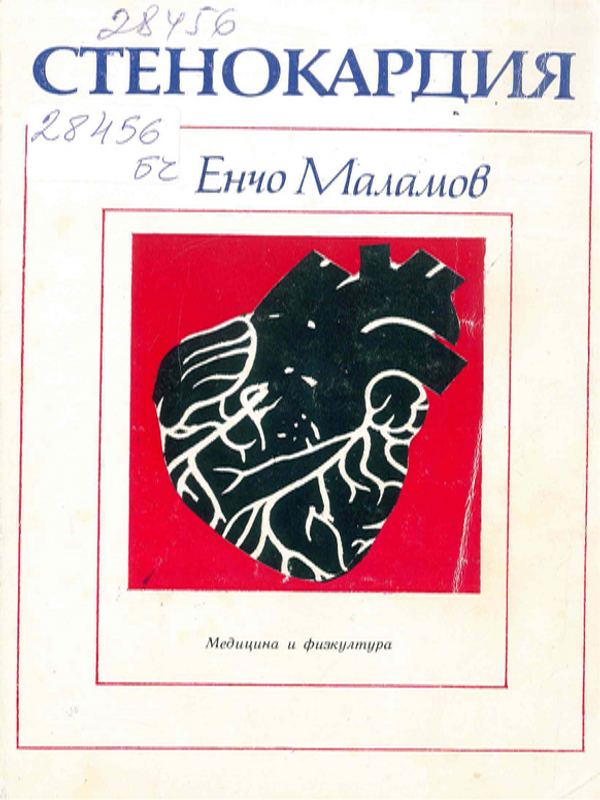 Стенокардия