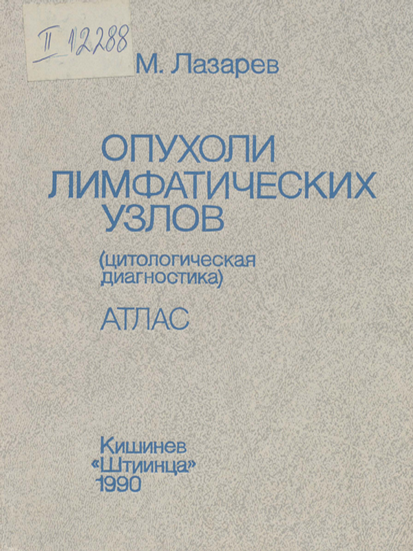 Опухоли лимфатических узлов