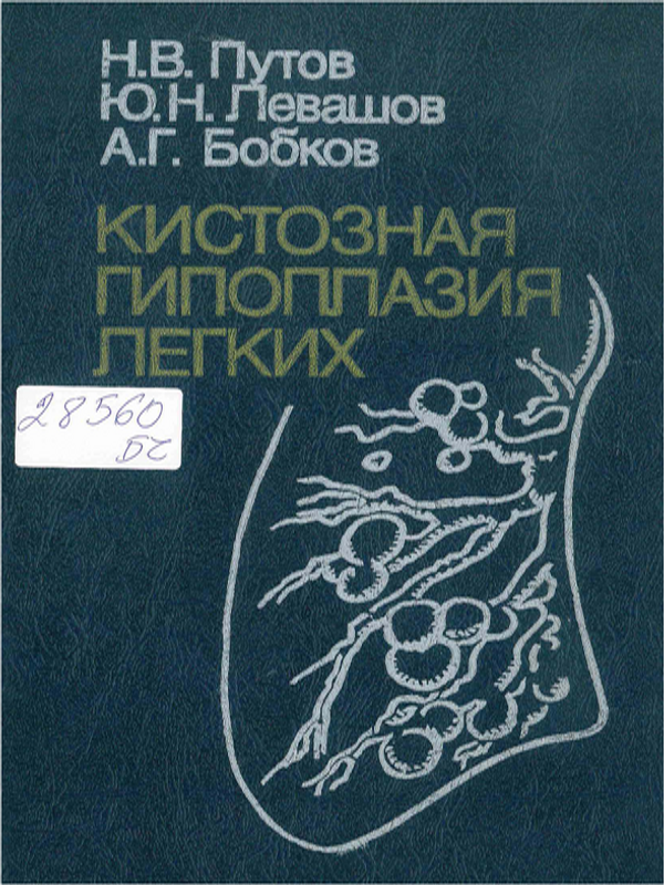 Кистозная гипоплазия легких