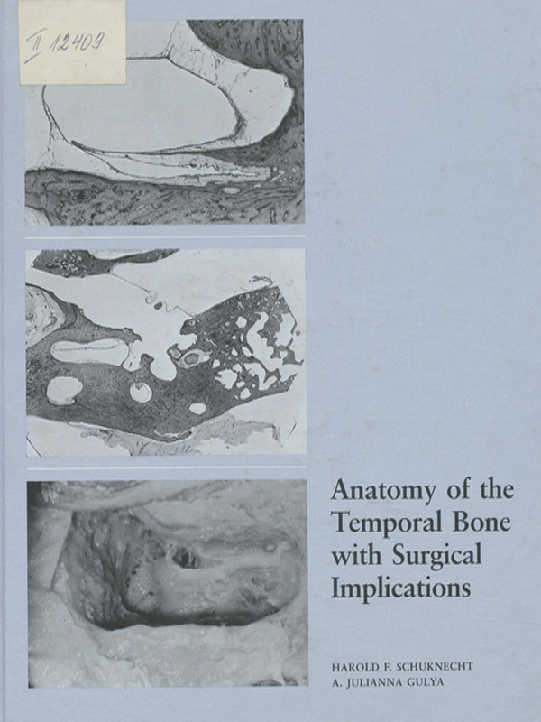 Anatomy of the temporal bone with surgical implications