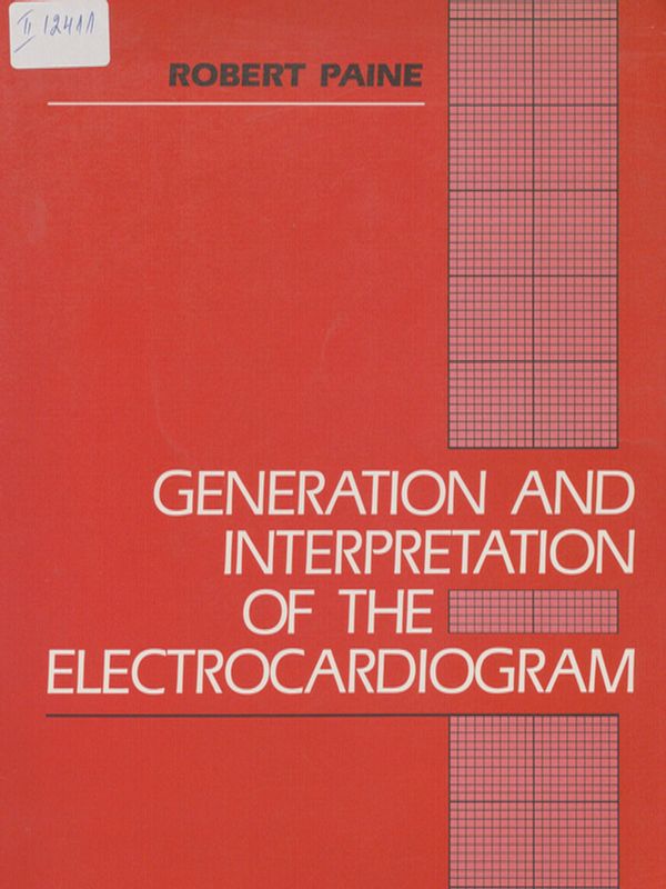 Generation and interpretation of electrocardiogram